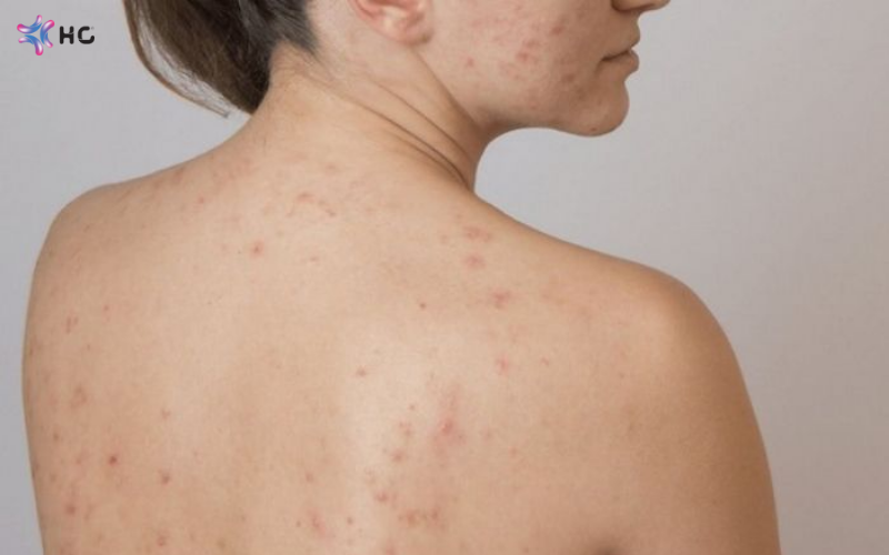 pH bao nhiêu là tốt